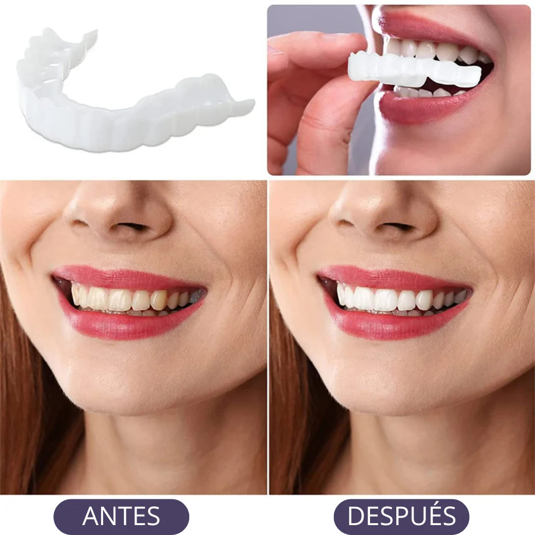 Oferta 2 x 1 Carillas Dentales Adaptables | Transforma tu Sonrisa